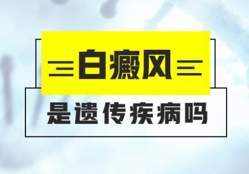 白癜風(fēng)會不會遺傳